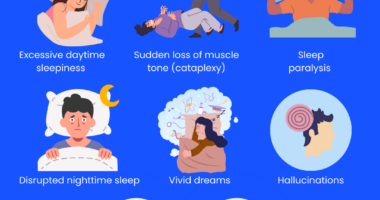 Illustration of narcolepsy symptoms