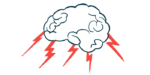 An illustration of the brain with red lightning bolts pointing to the different regions.