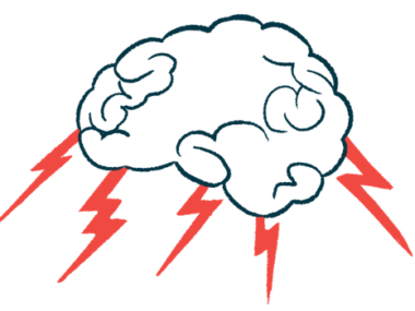 An illustration of the brain with red lightning bolts pointing to the different regions.