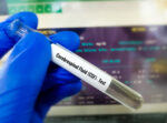 A gloved hand holds a vial labeled 