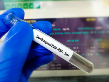 A gloved hand holds a vial labeled 