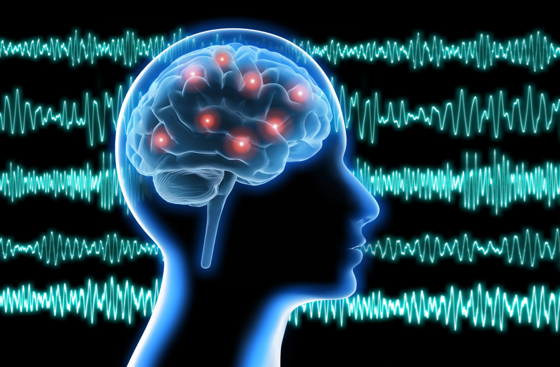 Brain waves serve as the backdrop to a human head, seen in profile, showing electrical impulses in the brain.