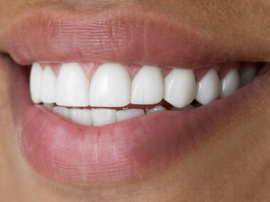 Close-up picture of a person smiling with clean white teeth.