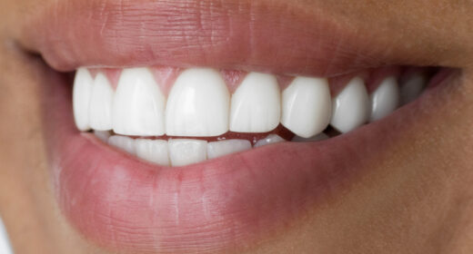 Close-up picture of a person smiling with clean white teeth.