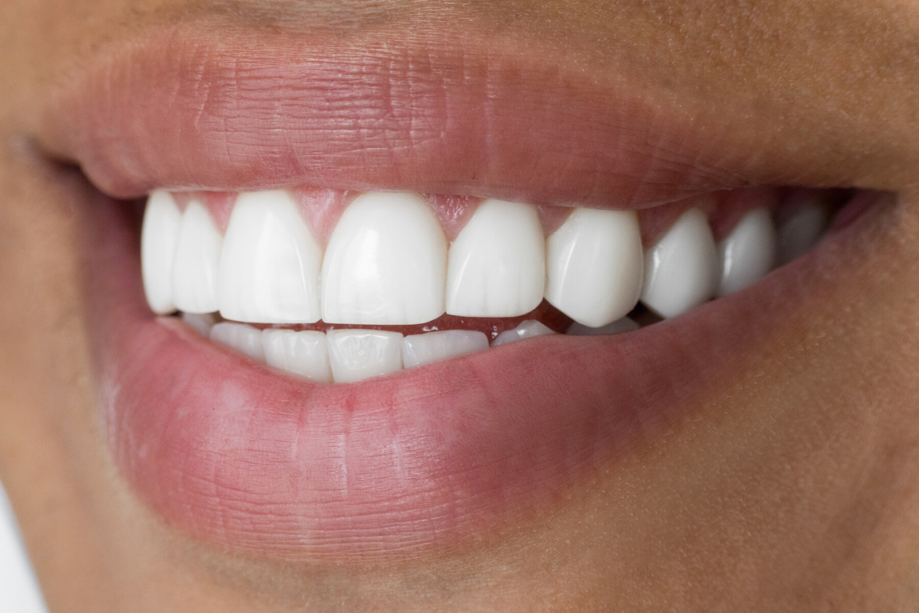 Close-up picture of a person smiling with clean white teeth.