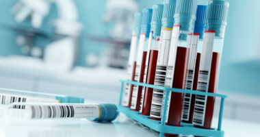 Two labeled vials lie on a counter in a laboratory alongside a rack of vials filled with blood.