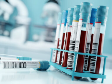 Two labeled vials lie on a counter in a laboratory alongside a rack of vials filled with blood.