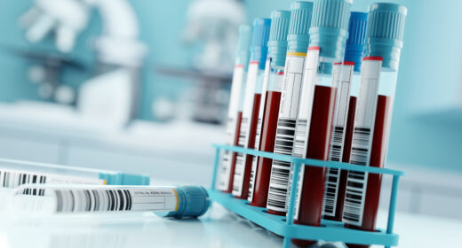 Two labeled vials lie on a counter in a laboratory alongside a rack of vials filled with blood.