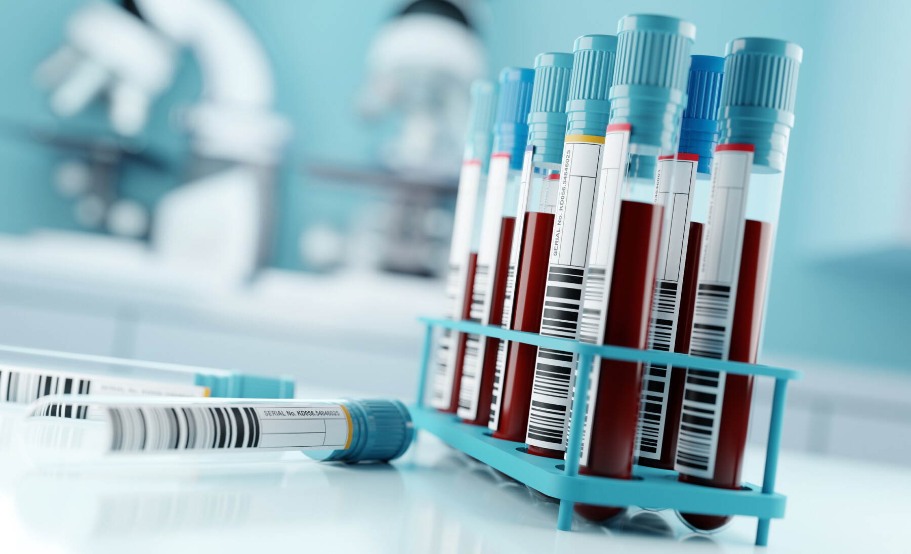 Two labeled vials lie on a counter in a laboratory alongside a rack of vials filled with blood.